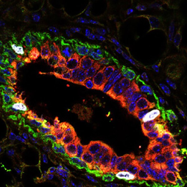 Immunofluorescent (IF) image, acquired with a fluorescence microscope, of mammary tissue sections from mice labeled with DSHB anti-Krt8 [TROMA-I] (in red). PMID: 39321020, Fig. 2I